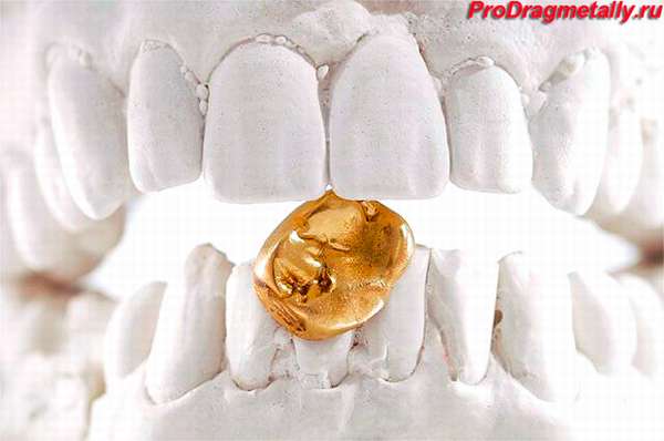 Зубной слепок с золотой коронкой